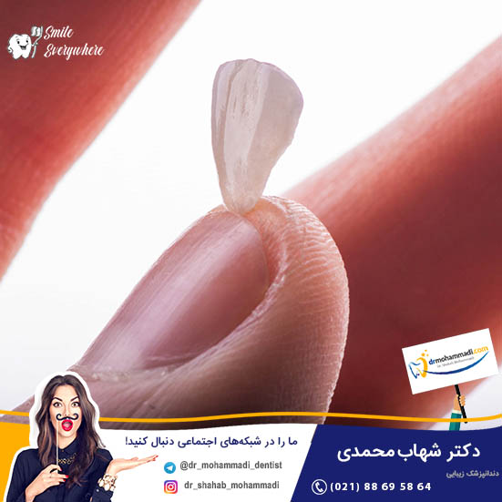 حساسیت دندان بعد از نصب ونیر های دندانی - کلینیک دندانپزشکی دکتر شهاب محمدی